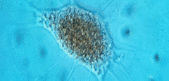 Vampyrella lateritia
