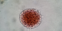 Vampyrella lateritia