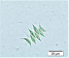 Tetradesmus lagerheimii