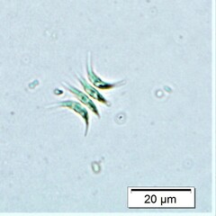 Tetradesmus lagerheimii