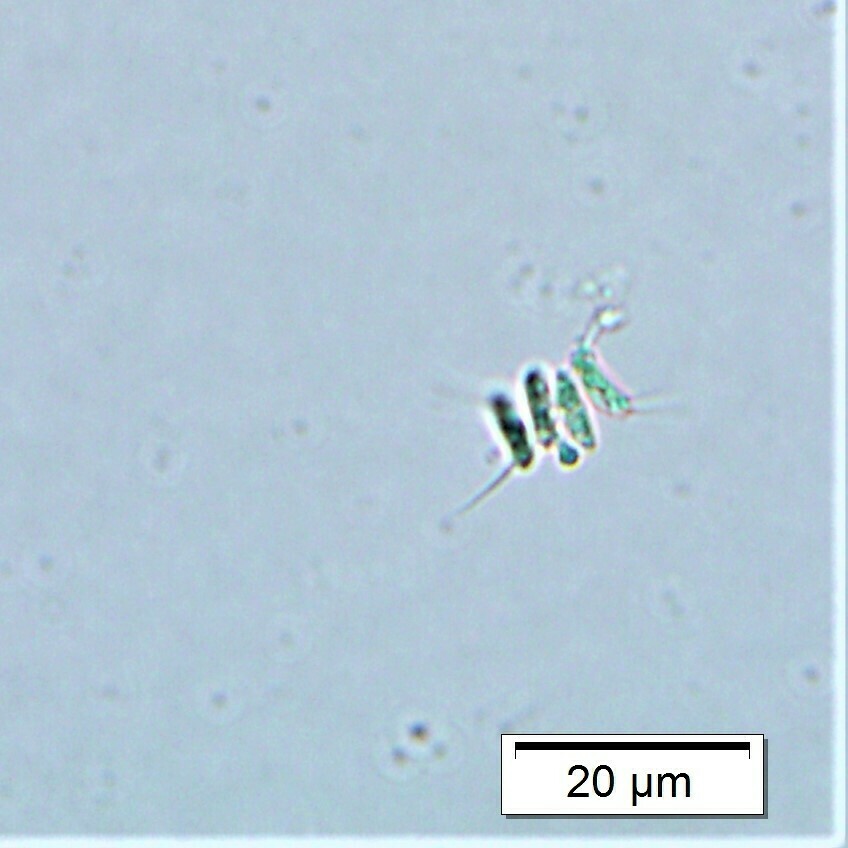 Desmodesmus intermedius (Desmodesmus intermedius)