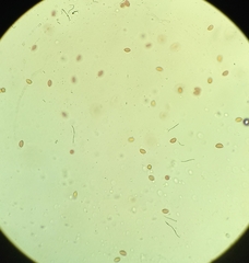 Hebeloma