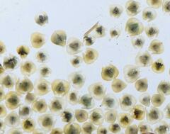 Cyprididae