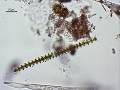Triploceras gracile