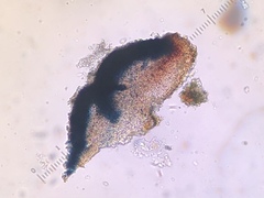 Bacidia crenulata