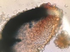 Bacidia crenulata