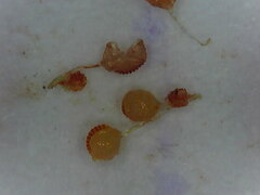 Polypodium interjectum