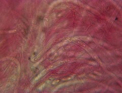 Sarcoscypha austriaca