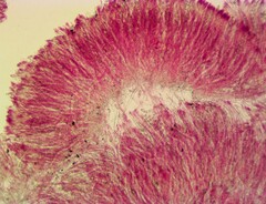 Sarcoscypha austriaca