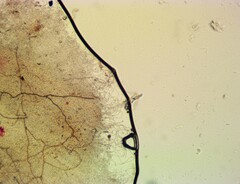 Sarcoscypha austriaca