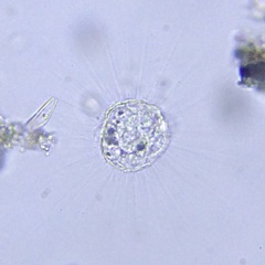 Heliozoa