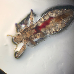Pediculus humanus capitis