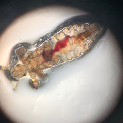 Pediculus humanus capitis
