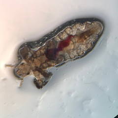 Pediculus humanus capitis
