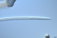 Bursaphelenchus xylophilus