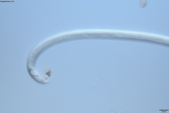 Bursaphelenchus xylophilus