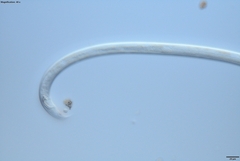 Bursaphelenchus xylophilus