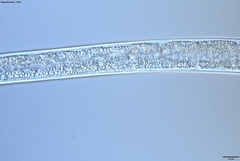 Bursaphelenchus xylophilus