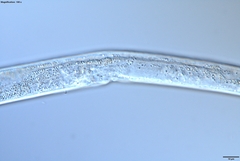 Bursaphelenchus xylophilus