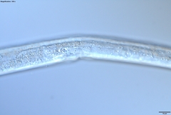 Bursaphelenchus xylophilus