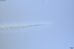 Bursaphelenchus xylophilus