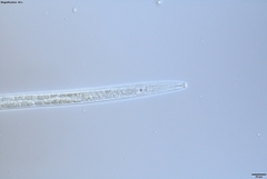 Bursaphelenchus xylophilus