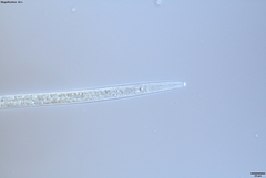 Bursaphelenchus xylophilus