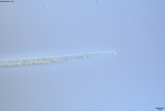 Bursaphelenchus xylophilus