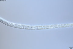 Bursaphelenchus xylophilus