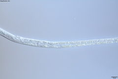 Bursaphelenchus xylophilus