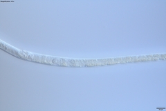 Bursaphelenchus xylophilus