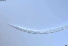 Bursaphelenchus xylophilus