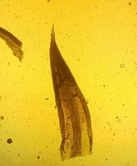 Pseudocrossidium hornschuchianum