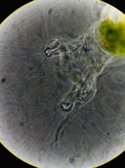 Collotheca