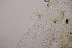 Hawksworthiana peltigericola