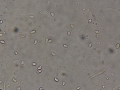 Leucopaxillus