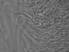 Dacrymyces corticioides