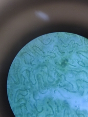 Nostoc commune