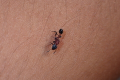 Dilobocondyla fouqueti