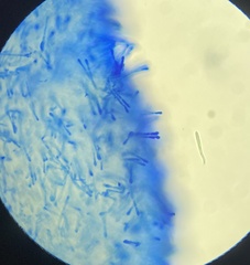 Lachnum brevipilosum