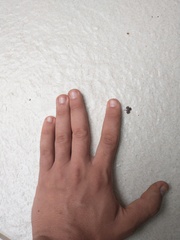 Brachycephalus hermogenesi