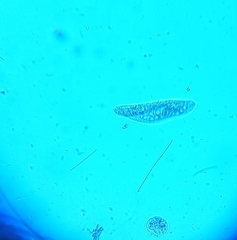 Paramecium