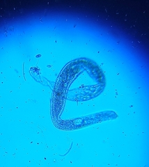Spirostomum