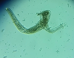 Spirostomum