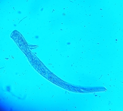 Spirostomum