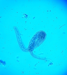 Spirostomum