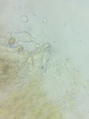 Cortinarius glaucocyanopus