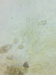 Cortinarius glaucocyanopus