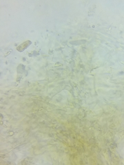 Cortinarius glaucocyanopus