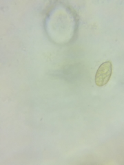 Cortinarius glaucocyanopus